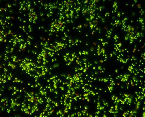 Pseudomonas - fluorescence stain